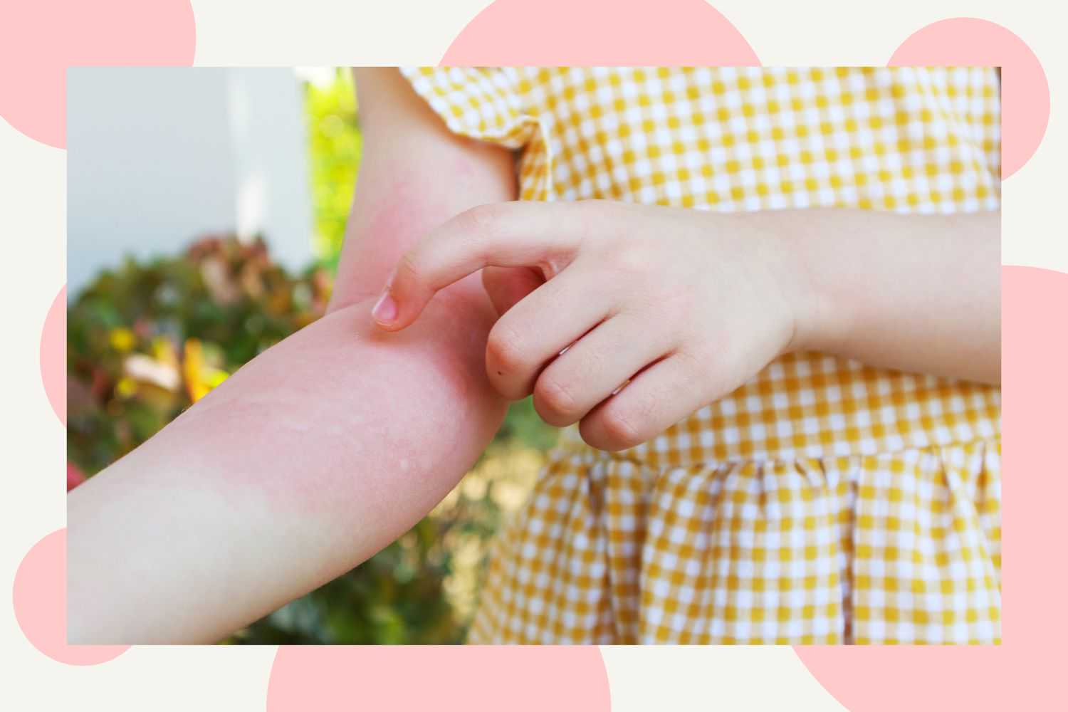 国家允许供卵吗现在_正规试管代孕哪里放心,试管移植着床后为什么不发育-移植