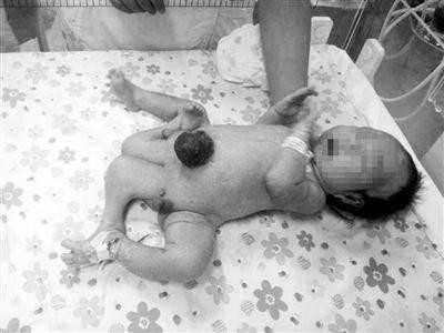 包生儿子多少钱-乌克兰试管做的几代-孕妇分娩被