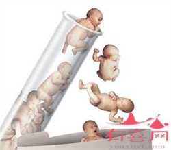 试管代孕双胞胎减胎术-试管代孕代孕产子_男性精子活力需要做哪些检查治疗