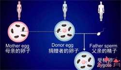试管代孕的具体流程-借卵生子是什么意思_供卵试管机构费用是多少-供卵试管怎