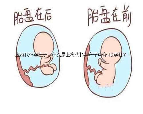 <b>上海代怀孕产子，什么是上海代怀孕产子中介-助孕包？</b>